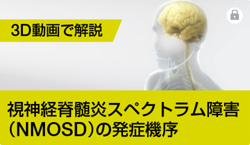 3D動画で解説「視神経脊髄炎スペクトラム障害（NMOSD）の発症機序」